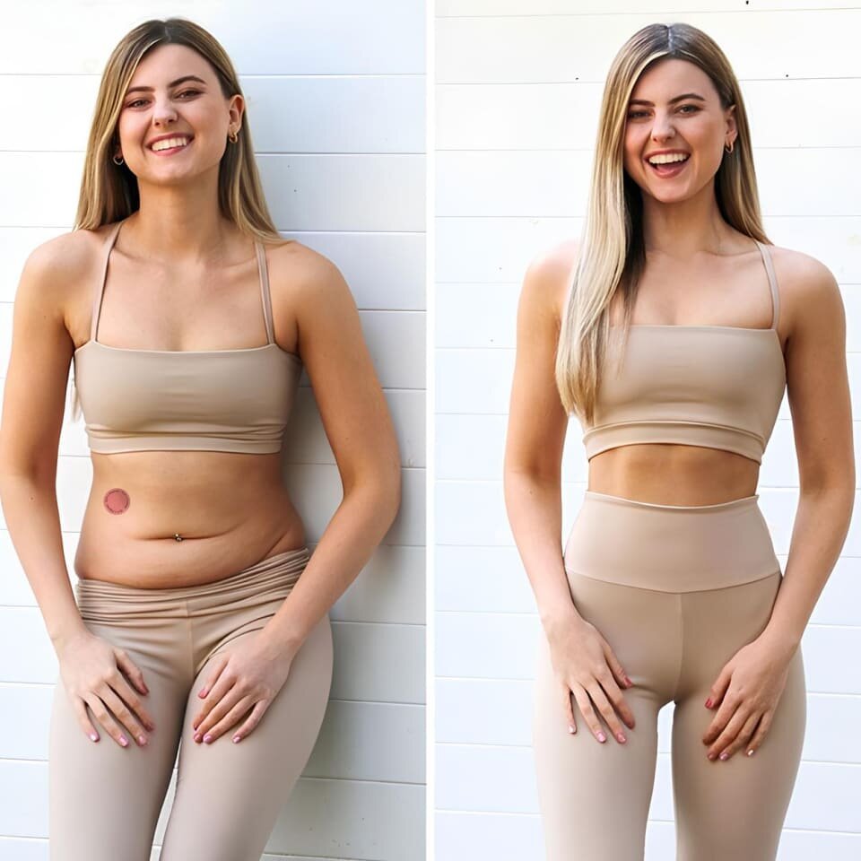 Cleraluxe Patches image